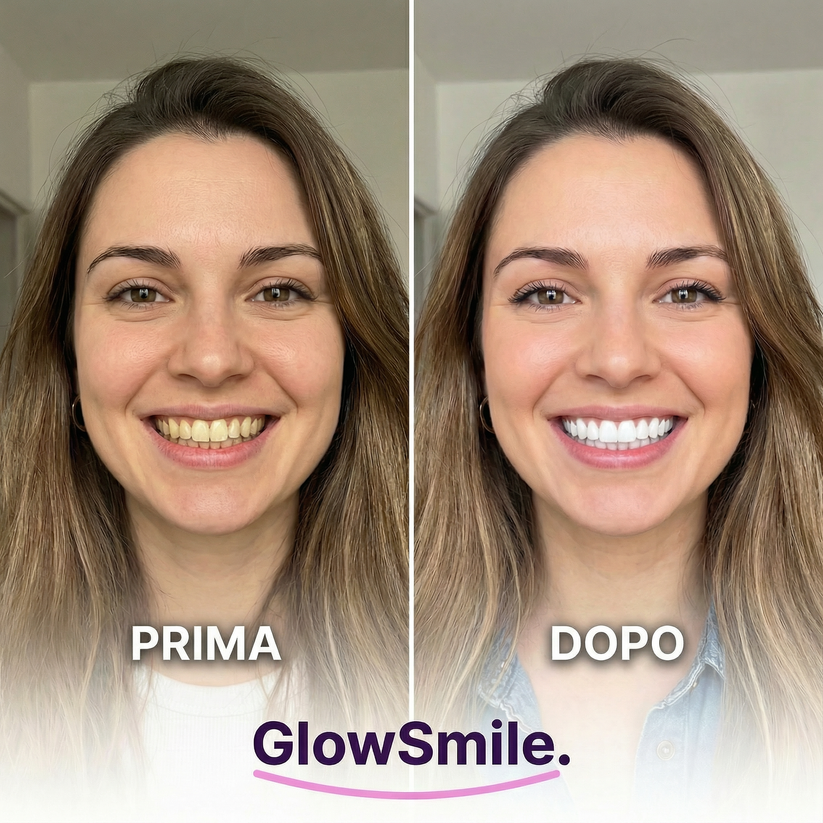 Strisce Sbiancanti GlowSmile™