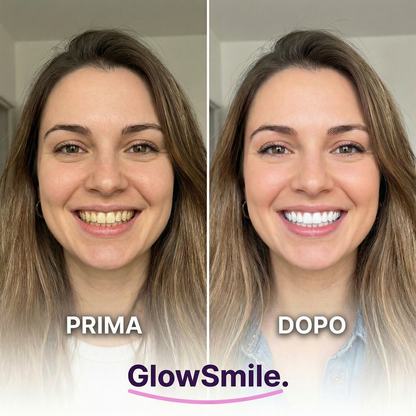 Strisce Sbiancanti GlowSmile™