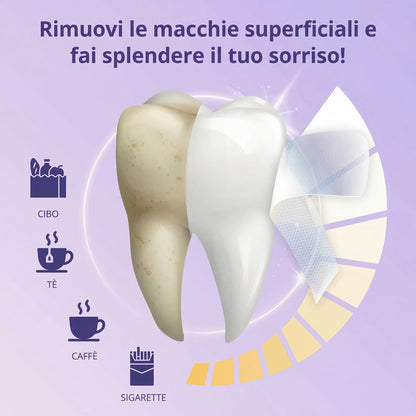 Strisce Sbiancanti GlowSmile™